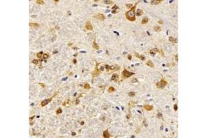 Immunohistochemistry of paraffin embedded rat spinal cord using NACAD (ABIN7074756) at dilution of 1:1000 (400x lens) (NACAD antibody)