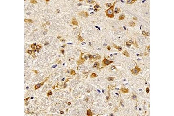 NACAD antibody