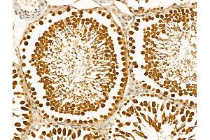 ABIN6261249 and ABIN6268912 at 1/100 staining Rat testis tissue by IHC-P.