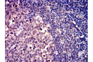 Immunohistochemical analysis of paraffin-embedded lymphoid tissues using CD267 mouse mAb with DAB staining. (TACI antibody)