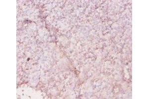 Immunohistochemistry of paraffin-embedded human tonsil tissue using ABIN7155601 at dilution of 1:20 (HLA-DRA antibody  (AA 28-254))