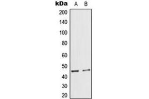 Western blot analysis of Cytokeratin 18 (pS33) expression in A431 (A), HeLa (B) whole cell lysates. (Cytokeratin 18 antibody  (N-Term, pSer33))