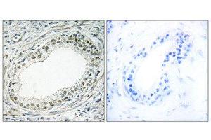 Immunohistochemistry (IHC) image for anti-Ribosomal Protein L36 (RPL36) (Internal Region) antibody (ABIN1850636) (RPL36 antibody  (Internal Region))