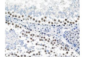 Phospho-JIP1 (Thr205) Antibody at 1/100 staining Rat testis tissue by IHC-P.