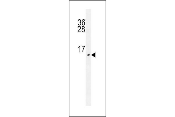 Urm1 antibody