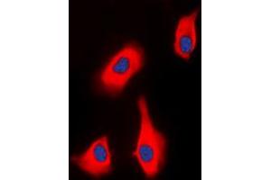 Immunofluorescent analysis of PTHR1 staining in HEK293T cells. (PTH1R antibody  (Center))