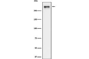 Western blot analysis of USP24 expression in HeLa cell lysate.