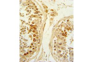 Formalin-fixed and paraffin-embedded human testis tissue reacted with SFRP1 Antibody (N-term), which was peroxidase-conjugated to the secondary antibody, followed by DAB staining. (SFRP1 antibody  (N-Term))