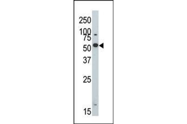 DYRK2 antibody  (N-Term)