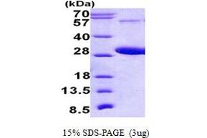 SDS-PAGE (SDS) image for RAB5C, Member RAS Oncogene Family (Rab5c) (AA 1-216) protein (His tag) (ABIN5852923)