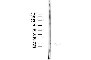 Western blot analysis of lysates from HUVEC cells(UV,30 min treatment), using GSB Antibody at 1/1000 dilution.