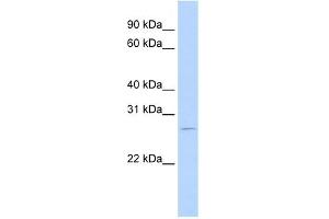 WB Suggested Anti-RBM38 Antibody Titration:  0.