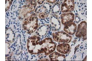 Immunohistochemical staining of paraffin-embedded Human Kidney tissue using anti-GRHPR mouse monoclonal antibody. (GRHPR antibody)