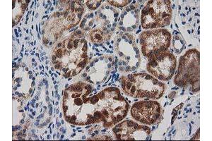 Immunohistochemical staining of paraffin-embedded Human Kidney tissue using anti-GRHPR mouse monoclonal antibody.