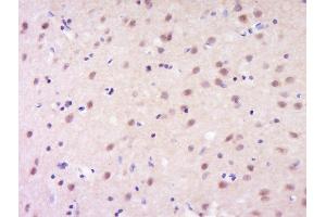 Paraformaldehyde-fixed, paraffin embedded rat brain, Antigen retrieval by boiling in sodium citrate buffer (pH6) for 15min, Block endogenous peroxidase by 3% hydrogen peroxide for 30 minutes, Blocking buffer (normal goat serum) at 37°C for 20min, Antibody incubation with Rabbit Anti-GSC Polyclonal Antibody, Unconjugated  at 1:200 overnight at 4°C, followed by a conjugated secondary and DAB staining. (GSC antibody  (AA 151-257))