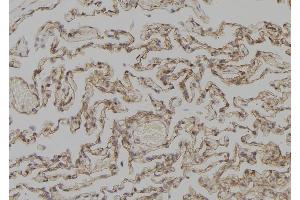 ABIN6277309 at 1/100 staining Human lung tissue by IHC-P. (KRT4 antibody)