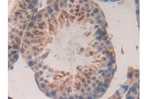 Immunohistochemistry (IHC) image for anti-Mucin 1 (MUC1) (AA 410-525) antibody (ABIN7440383)