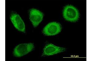 Immunofluorescence of purified MaxPab antibody to RPN2 on HeLa cell. (Ribophorin II antibody  (AA 1-631))