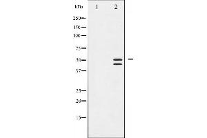 Western blot analysis of VASP phosphorylation expression in NIH-3T3 whole cell lysates,The lane on the left is treated with the antigen-specific peptide.