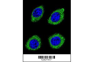 Confocal immunofluorescent analysis of HSD11B1L Antibody with U-251MG cell followed by Alexa Fluor 488-conjugated goat anti-rabbit lgG (green). (HSD11B1L antibody  (C-Term))
