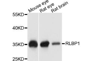 Western blot analysis of extract of various cells, using RLBP1 antibody. (RLBP1 antibody)