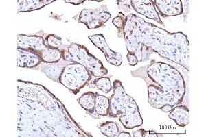 IHC analysis of RPN1 using anti-RPN1 antibody (ABIN7600447). (RPN1 antibody  (AA 196-495))