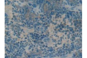 Detection of RPRM in Rat Spleen Tissue using Polyclonal Antibody to Reprimo (RPRM)