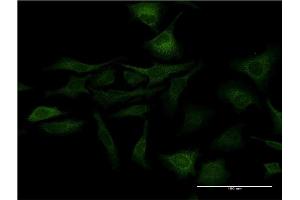 Immunofluorescence of monoclonal antibody to SFN on HeLa cell. (14-3-3 sigma/SFN antibody  (AA 1-248))