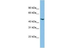 WB Suggested Anti-C17orf75 Antibody Titration: 0. (C17orf75 antibody  (Middle Region))