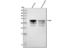 Western blot analysis of PRNP using anti-PRNP antibody (ABIN7606038).