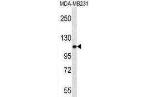 Western Blotting (WB) image for anti-Actinin, alpha 3 (ACTN3) antibody (ABIN2996665) (ACTN3 antibody)