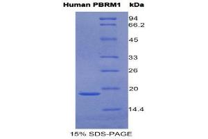 SDS-PAGE (SDS) image for Polybromo 1 (PBRM1) (AA 1152-1273) protein (His tag) (ABIN2121927)