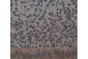 Used in DAB staining on fromalin fixed paraffin- embedded Kidney tissue (TRRAP antibody  (AA 3534-3770))