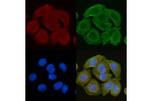 ABIN6260056 and ABIN6272251 staining Hela cells(30 min of UV treatment) by IF/ICC. (ARRDC4 antibody  (Internal Region))