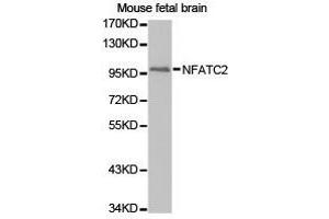 Western Blotting (WB) image for anti-Nuclear Factor of Activated T-Cells, Cytoplasmic, Calcineurin-Dependent 2 (NFAT1) antibody (ABIN1873890) (NFAT1 antibody)