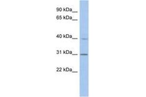 Image no. 1 for anti-Post-GPI Attachment To Proteins 3 (PGAP3) (AA 71-120) antibody (ABIN6743545) (PGAP3 antibody  (AA 71-120))