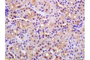 Formalin-fixed and paraffin embedded rat kidney labeled with Anti-CAP1/PARK7 Polyclonal Antibody, Unconjugated (ABIN674739) at 1:200 followed by conjugation to the secondary antibody and DAB staining. (PARK7/DJ1 antibody  (AA 101-189))