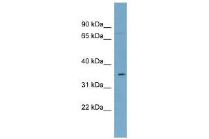SLC39A2 antibody used at 1 ug/ml to detect target protein.