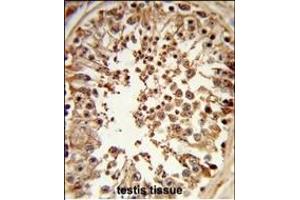 Formalin-fixed and paraffin-embedded human testis tissue reacted with DMC1 Antibody (N-term), which was peroxidase-conjugated to the secondary antibody, followed by DAB staining. (DMC1 antibody  (N-Term))