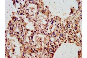 IHC image of ABIN7143473 diluted at 1:300 and staining in paraffin-embedded human lung tissue performed on a Leica BondTM system. (ARL1 antibody  (AA 2-181))