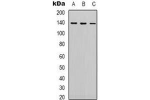 Western blot analysis of HER2 expression in Hela (A), 293 (B), Jurkat (C) whole cell lysates. (ErbB2/Her2 antibody)