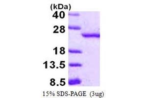 SDS-PAGE (SDS) image for Retinoblastoma Binding Protein 9 (RBBP9) (AA 1-186) protein (His tag) (ABIN667618) (RBBP9 Protein (AA 1-186) (His tag))