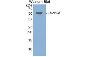 Detection of Recombinant FGb, Mouse using Polyclonal Antibody to Fibrinogen Beta Chain (FGB) (Fibrinogen beta Chain antibody  (AA 35-481))