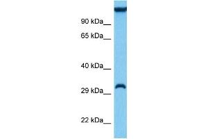 Host:  Mouse  Target Name:  SIAH1A  Sample Tissue:  Mouse Liver  Antibody Dilution:  1ug/ml (SIAH1 antibody  (N-Term))
