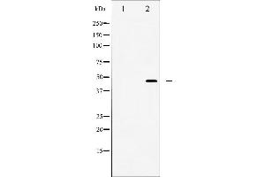 Western Blotting (WB) image for anti-Jun Proto-Oncogene (JUN) (pThr91) antibody (ABIN6256604)