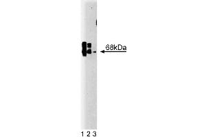 Western blot analysis of CaM Kinase Kinase on rat brain lysate. (CaM Kinase Kinase (AA 341-504) antibody)