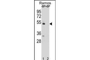 Western blot analysis of ZDHC2 Antibody (N-term) Pab (ABIN651781 and ABIN2840397) pre-incubated without(lane 1) and with(lane 2) blocking peptide in Ramos cell line lysate. (ZDHHC2 antibody  (AA 77-106))