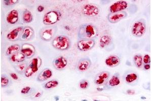 Anti-ADAMTS5 antibody  ABIN1048296 IHC staining of human cartilage. (ADAMTS5 antibody  (C-Term))