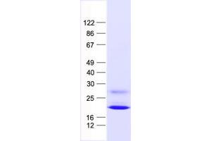 Validation with Western Blot
