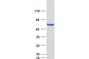 Western Blotting (WB) image for ACC Synthase-Like Protein 1 (ACCS) (Transcript Variant 1) protein (Myc-DYKDDDDK Tag) (ABIN2728800)